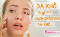 Chăm sóc da khô đúng cách