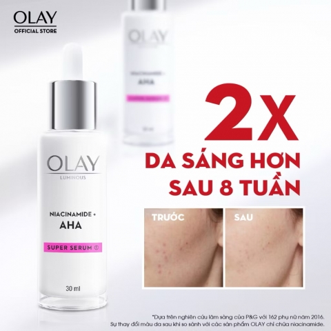 Kem dưỡng Olay Niacinamide + AHA Moisturiser Giảm Mụn Mờ Thâm 50g - Màu Hồng
